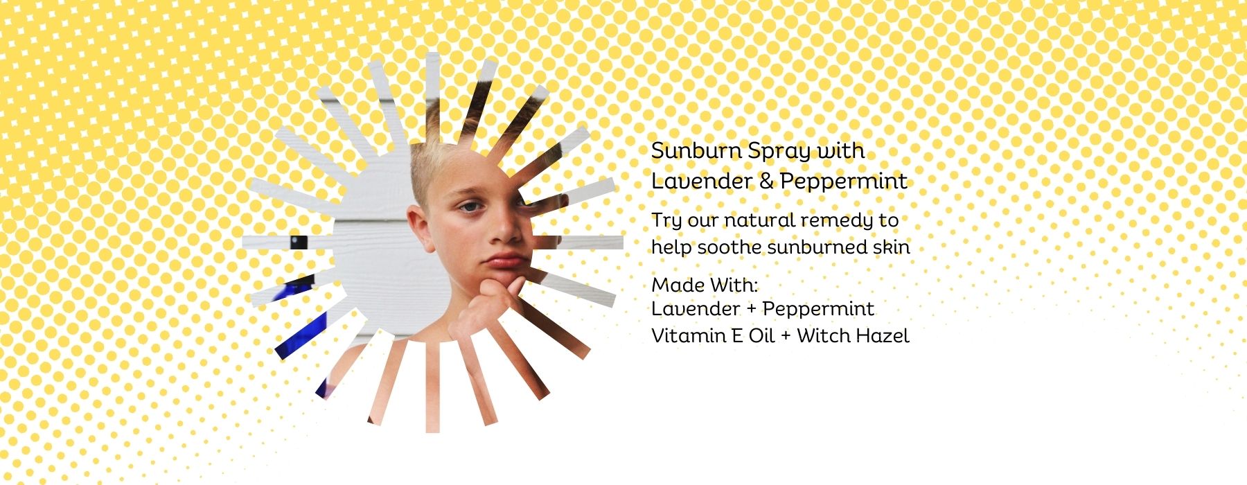 Wyndmere DIY Sunburn Relief Spray. Recipe made is with lavender, and Peppermint essential oils.