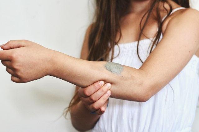 Bite & Sting Poultice with Lavender and Chamomile - Wyndmere Naturals