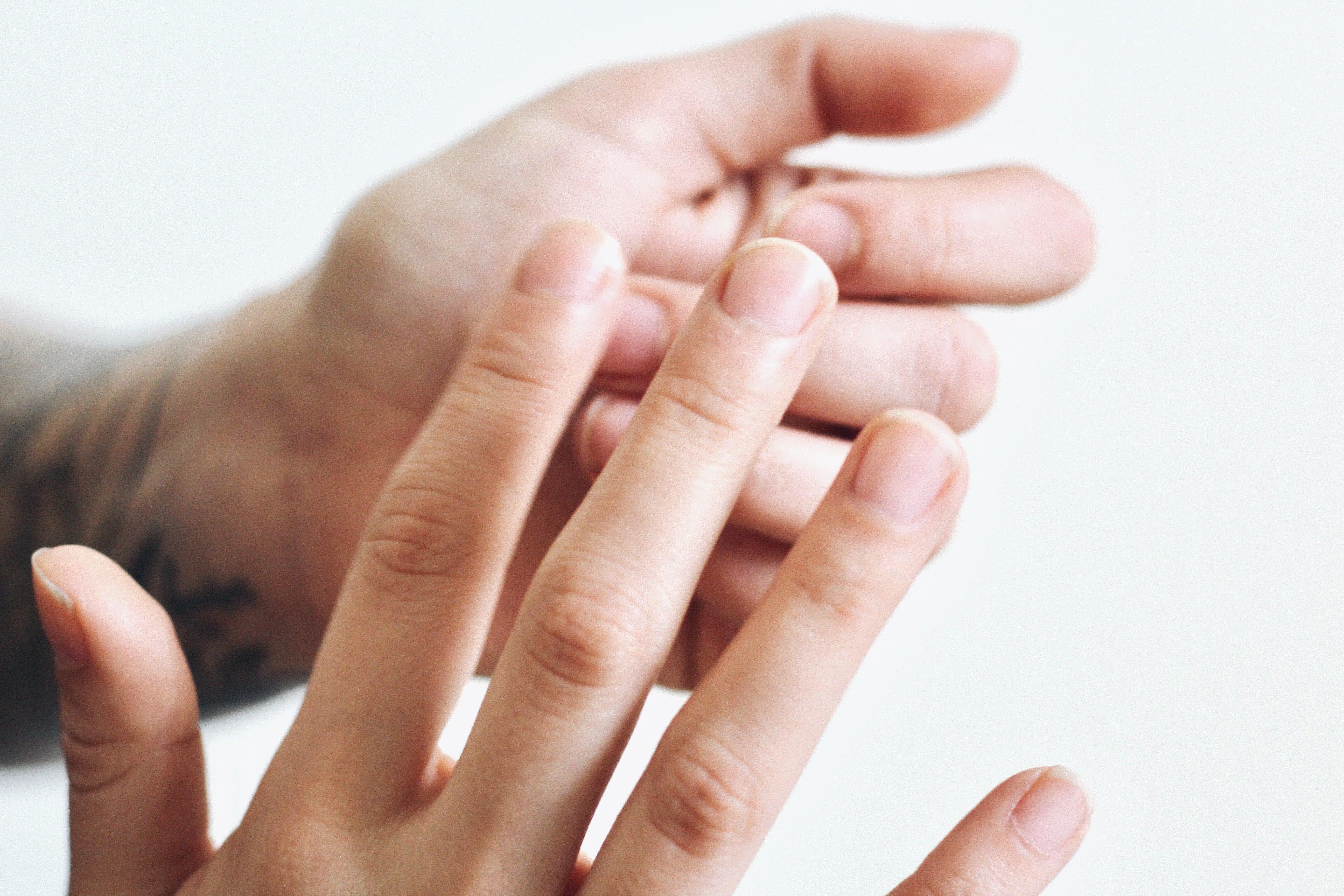 Dry, DRY Very Dry Hands - Wyndmere Naturals