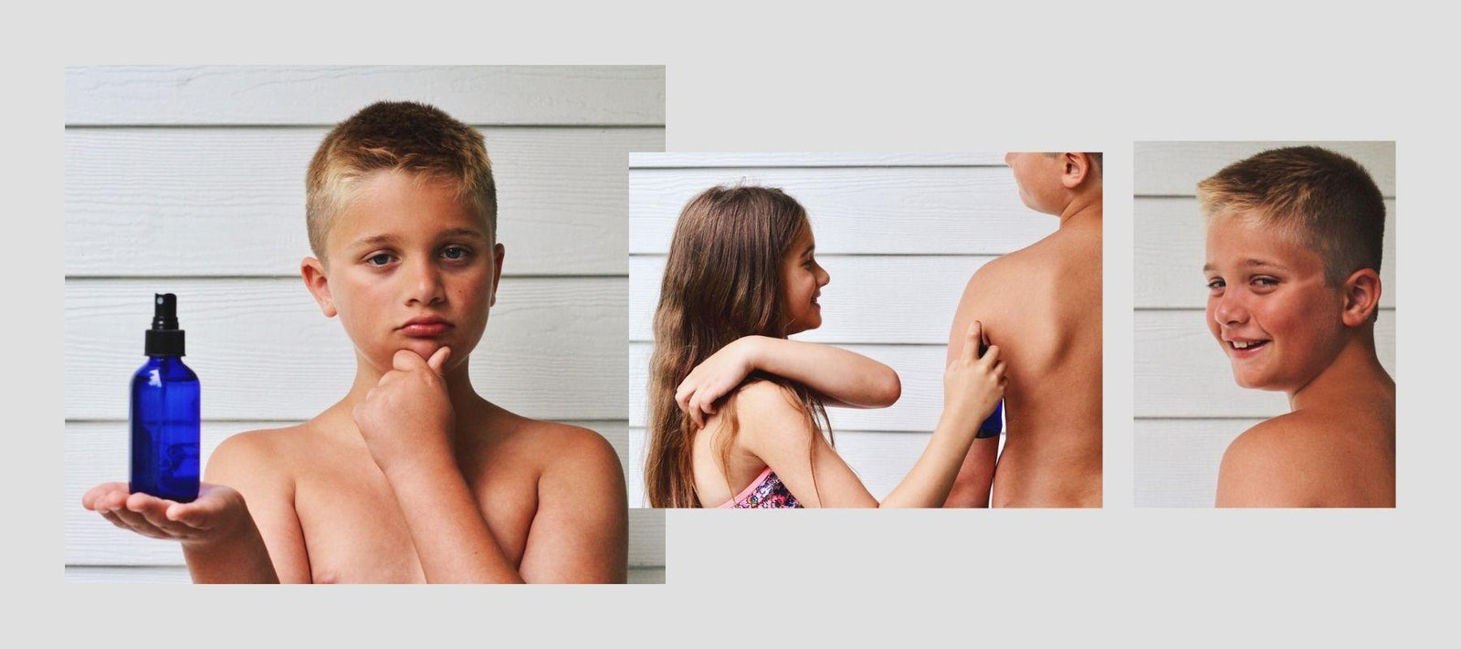 Sun Burn - Wyndmere Naturals