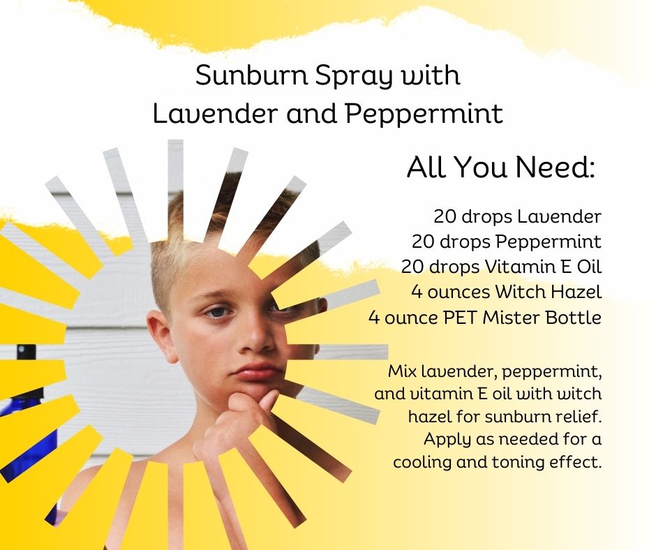 Essential Oil Recipe for Sunburn Relief - Roller Remedy & Body Oil